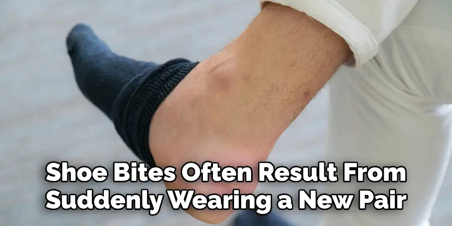 Shoe Bites Often Result From
Suddenly Wearing a New Pair